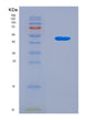 SDS-PAGE analysis of Human OLIG2 (Oligodendrocyte Transcription Factor 2) - Recombinant Protein, CAT# BLT-08839P showing >90% purity under 15% SDS-PAGE (Reduced)