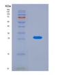 SDS-PAGE analysis of Mouse C1qa (Complement C1Q Subcomponent Subunit A) - Recombinant Protein, CAT# BLT-08841P showing >90% purity under 15% SDS-PAGE (Reduced)
