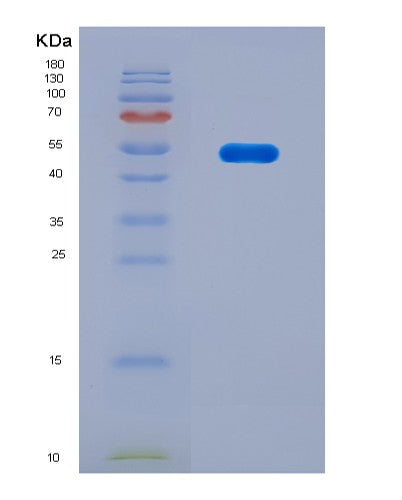 SDS-PAGE analysis of Mouse Ctsk (Cathepsin K) - Recombinant Protein, CAT# BLT-08842P showing >90% purity under 15% SDS-PAGE (Reduced)