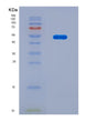 SDS-PAGE analysis of Mouse Ctsk (Cathepsin K) - Recombinant Protein, CAT# BLT-08842P showing >90% purity under 15% SDS-PAGE (Reduced)