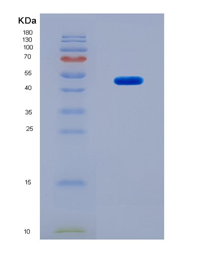 SDS-PAGE analysis of Human HNRNPA2B1 (Heterogeneous Nuclear Ribonucleoproteins A2/B1) - Recombinant Protein, CAT# BLT-08846P showing >90% purity under 15% SDS-PAGE (Reduced)