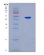 SDS-PAGE analysis of Human HNRNPA2B1 (Heterogeneous Nuclear Ribonucleoproteins A2/B1) - Recombinant Protein, CAT# BLT-08846P showing >90% purity under 15% SDS-PAGE (Reduced)