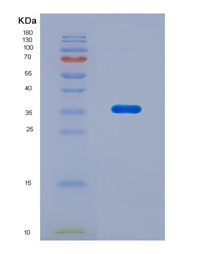 SDS-PAGE analysis of Human Optic Atrophy 1, Autosomal Dominant (OPA1) - Recombinant Protein, CAT# BLT-08848P showing >90% purity under 15% SDS-PAGE (Reduced)