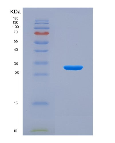 SDS-PAGE analysis of Human MATK (Megakaryocyte-Associated Tyrosine-Protein Kinase) - Recombinant Protein, CAT# BLT-08850P showing >90% purity under 15% SDS-PAGE (Reduced)