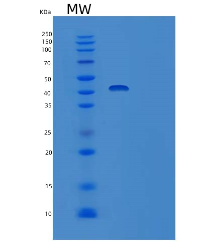 SDS-PAGE analysis of Mouse Tau (MAPT) - Recombinant Protein, CAT# BLT-08855P showing >90% purity under 15% SDS-PAGE (Reduced)