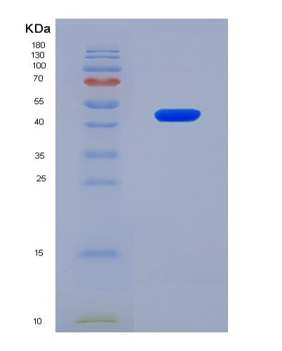 SDS-PAGE analysis of Human COL5A2 (Collagen Alpha-2(V) Chain) - Recombinant Protein, CAT# BLT-08856P showing >90% purity under 15% SDS-PAGE (Reduced)