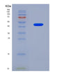 SDS-PAGE analysis of Human COL5A2 (Collagen Alpha-2(V) Chain) - Recombinant Protein, CAT# BLT-08856P showing >90% purity under 15% SDS-PAGE (Reduced)