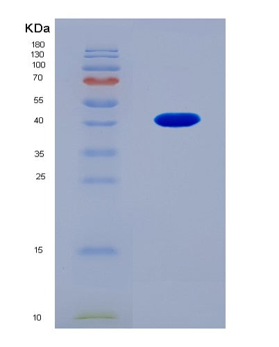 SDS-PAGE analysis of Human COL5A2 (Collagen Alpha-2(V) Chain) - Recombinant Protein, CAT# BLT-08857P showing >90% purity under 15% SDS-PAGE (Reduced)