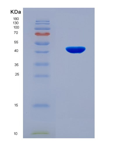SDS-PAGE analysis of Human COL5A2 (Collagen Alpha-2(V) Chain) - Recombinant Protein, CAT# BLT-08858P showing >90% purity under 15% SDS-PAGE (Reduced)