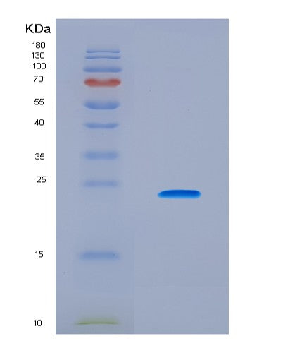 SDS-PAGE analysis of Human CTCF (Transcriptional Repressor Ctcf) - Recombinant Protein, CAT# BLT-08860P showing >90% purity under 15% SDS-PAGE (Reduced)