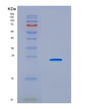 SDS-PAGE analysis of Human CTCF (Transcriptional Repressor Ctcf) - Recombinant Protein, CAT# BLT-08860P showing >90% purity under 15% SDS-PAGE (Reduced)