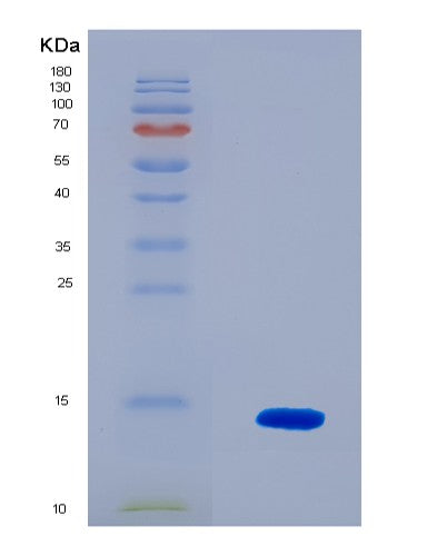 SDS-PAGE analysis of Human VAMP2 (Vesicle-Associated Membrane Protein 2) - Recombinant Protein, CAT# BLT-08862P showing >90% purity under 15% SDS-PAGE (Reduced)