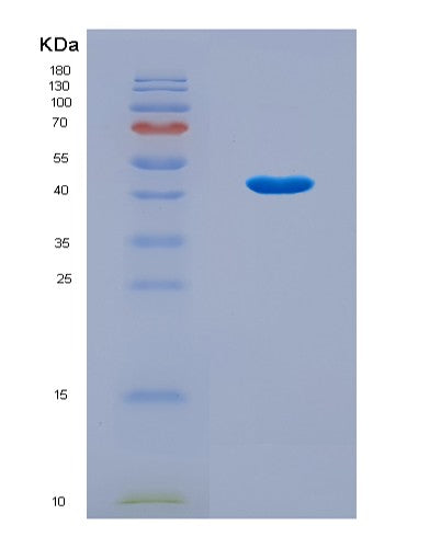 SDS-PAGE analysis of Human SKP2 (S-Phase Kinase-Associated Protein 2) - Recombinant Protein, CAT# BLT-08865P showing >90% purity under 15% SDS-PAGE (Reduced)
