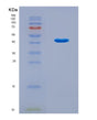 SDS-PAGE analysis of Human SKP2 (S-Phase Kinase-Associated Protein 2) - Recombinant Protein, CAT# BLT-08865P showing >90% purity under 15% SDS-PAGE (Reduced)