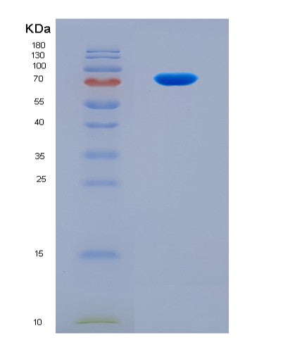 SDS-PAGE analysis of Human IFIT3 (Interferon-Induced Protein With Tetratricopeptide Repeats 3) - Recombinant Protein, CAT# BLT-08867P showing >90% purity under 15% SDS-PAGE (Reduced)