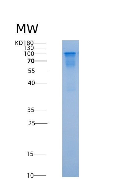 SDS-PAGE analysis of Human NSD3 (Histone-Lysine N-Methyltransferase Nsd3) - Recombinant Protein, CAT# BLT-08872P showing >85% purity under 15% SDS-PAGE (Reduced)