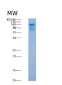 SDS-PAGE analysis of Human NSD3 (Histone-Lysine N-Methyltransferase Nsd3) - Recombinant Protein, CAT# BLT-08872P showing >85% purity under 15% SDS-PAGE (Reduced)