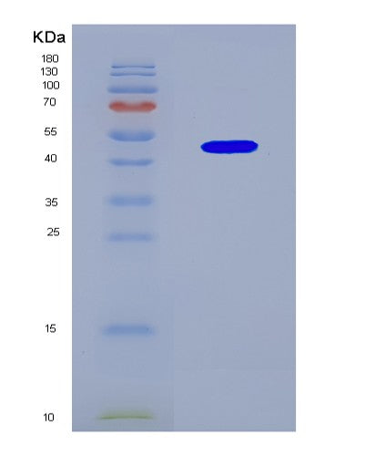 SDS-PAGE analysis of Human SHFL (Shiftless Antiviral Inhibitor Of Ribosomal Frameshifting Protein) - Recombinant Protein, CAT# BLT-08873P showing >85% purity under 15% SDS-PAGE (Reduced)