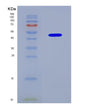 SDS-PAGE analysis of Human SHFL (Shiftless Antiviral Inhibitor Of Ribosomal Frameshifting Protein) - Recombinant Protein, CAT# BLT-08873P showing >85% purity under 15% SDS-PAGE (Reduced)