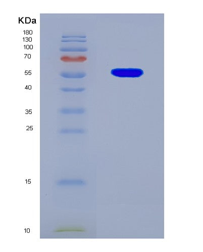 SDS-PAGE analysis of Human PTPA (Serine/Threonine-Protein Phosphatase 2A Activator) - Recombinant Protein, CAT# BLT-08874P showing >85% purity under 15% SDS-PAGE (Reduced)