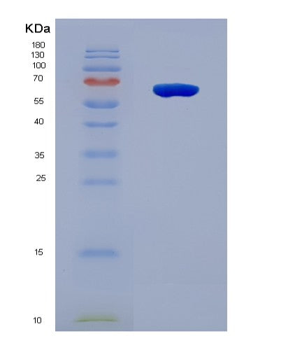 SDS-PAGE analysis of Human DDX56 (Probable Atp-Dependent Rna Helicase Ddx56) - Recombinant Protein, CAT# BLT-08875P showing >90% purity under 15% SDS-PAGE (Reduced)