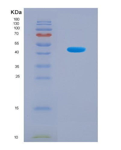 SDS-PAGE analysis of Human KRT17 (Keratin, Type I Cytoskeletal 17) - Recombinant Protein, CAT# BLT-08878P showing >90% purity under 15% SDS-PAGE (Reduced)