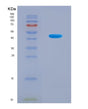 SDS-PAGE analysis of Human KRT17 (Keratin, Type I Cytoskeletal 17) - Recombinant Protein, CAT# BLT-08878P showing >90% purity under 15% SDS-PAGE (Reduced)