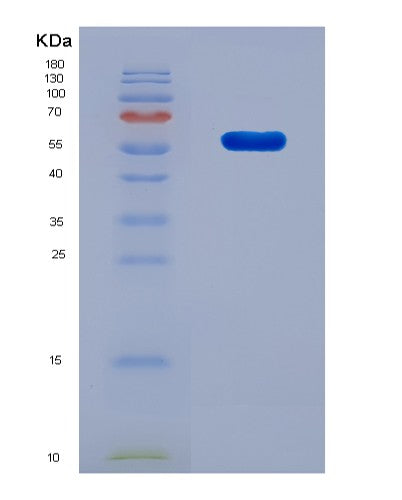 SDS-PAGE analysis of Human (Line-1 Retrotransposable Element Orf2 Protein) - Recombinant Protein, CAT# BLT-08739P showing >90% purity under 15% SDS-PAGE (Reduced)