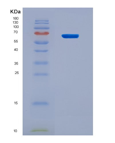 SDS-PAGE analysis of Human NR2E1 (Nuclear Receptor Subfamily 2 Group E Member 1) - Recombinant Protein, CAT# BLT-08879P showing >90% purity under 15% SDS-PAGE (Reduced)