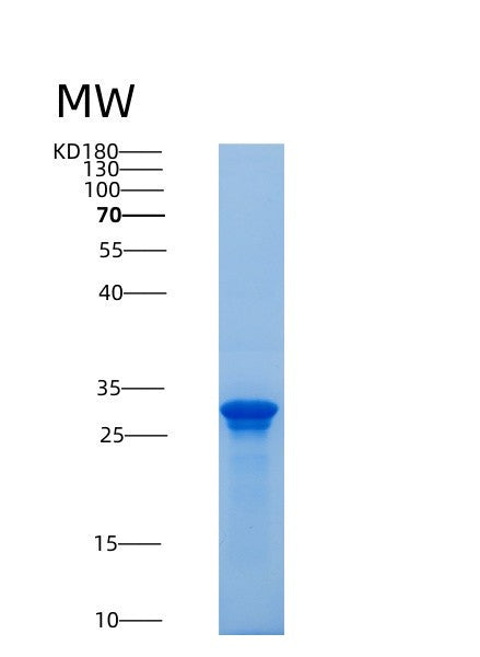SDS-PAGE analysis of Mouse Saa3 (Serum Amyloid A-3 Protein) - Recombinant Protein, CAT# BLT-08880P showing >85% purity under 15% SDS-PAGE (Reduced)