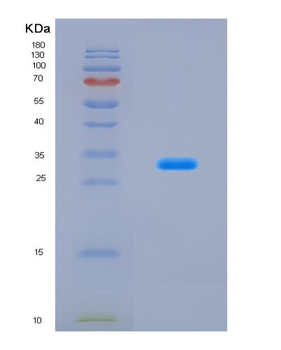 SDS-PAGE analysis of Mouse Lgr5 (Leucine-Rich Repeat-Containing G-Protein Coupled Receptor 5) - Recombinant Protein, CAT# BLT-08883P showing >90% purity under 15% SDS-PAGE (Reduced)