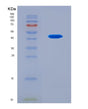 SDS-PAGE analysis of Human FTSJ3 (Pre-Rrna 2'-O-Ribose Rna Methyltransferase Ftsj3) - Recombinant Protein, CAT# BLT-08884P showing >90% purity under 15% SDS-PAGE (Reduced)
