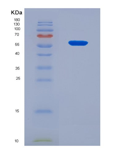 SDS-PAGE analysis of Human IL4I1 (L-Amino-Acid Oxidase) - Recombinant Protein, CAT# BLT-08886P showing >90% purity under 15% SDS-PAGE (Reduced)