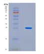 SDS-PAGE analysis of Human SLC2A9 (Solute Carrier Family 2, Facilitated Glucose Transporter Member 9) - Recombinant Protein, CAT# BLT-08887P showing >90% purity under 15% SDS-PAGE (Reduced)