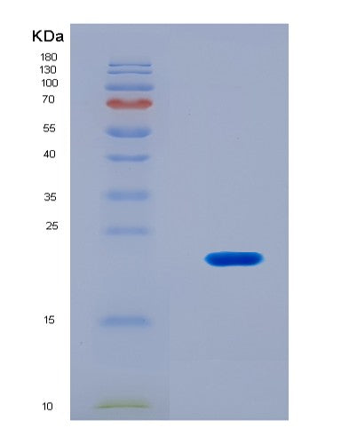 SDS-PAGE analysis of Mouse Tp53bp1 (Tp53-Binding Protein 1) - Recombinant Protein, CAT# BLT-08888P showing >90% purity under 15% SDS-PAGE (Reduced)