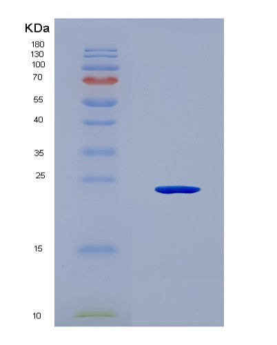 SDS-PAGE analysis of Mouse Wdr11 (Wd Repeat-Containing Protein 11) - Recombinant Protein, CAT# BLT-08891P showing >90% purity under 15% SDS-PAGE (Reduced)