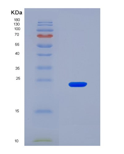 SDS-PAGE analysis of Human WDR11 (Wd Repeat-Containing Protein 11) - Recombinant Protein, CAT# BLT-08893P showing >90% purity under 15% SDS-PAGE (Reduced)