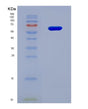 SDS-PAGE analysis of Human P4HA1 (Prolyl 4-Hydroxylase Subunit Alpha-1) - Recombinant Protein, CAT# BLT-08894P showing >90% purity under 15% SDS-PAGE (Reduced)