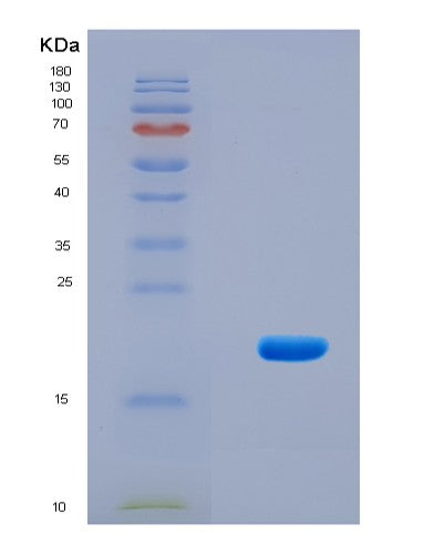 SDS-PAGE analysis of Human PLA2G10 (Group 10 Secretory Phospholipase A2) - Recombinant Protein, CAT# BLT-08898P showing >90% purity under 15% SDS-PAGE (Reduced)