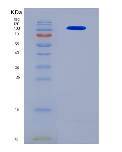 SDS-PAGE analysis of Human RECK (Reversion-Inducing Cysteine-Rich Protein With Kazal Motifs) - Recombinant Protein, CAT# BLT-08901P showing >90% purity under 15% SDS-PAGE (Reduced)