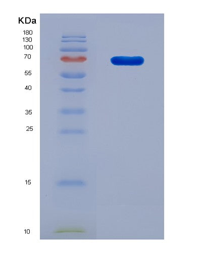 SDS-PAGE analysis of Human F2 (Prothrombin) - Recombinant Protein, CAT# BLT-08902P showing >90% purity under 15% SDS-PAGE (Reduced)
