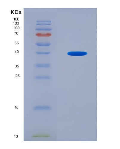 SDS-PAGE analysis of Mouse Nt5c3a (Cytosolic 5'-Nucleotidase 3A) - Recombinant Protein, CAT# BLT-08903P showing >90% purity under 15% SDS-PAGE (Reduced)