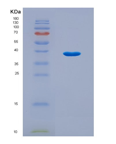 SDS-PAGE analysis of Human SAP30 (Histone Deacetylase Complex Subunit Sap30) - Recombinant Protein, CAT# BLT-08904P showing >90% purity under 15% SDS-PAGE (Reduced)