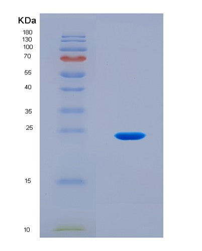 SDS-PAGE analysis of Human SIN3A (Paired Amphipathic Helix Protein Sin3A) - Recombinant Protein, CAT# BLT-08907P showing >90% purity under 15% SDS-PAGE (Reduced)
