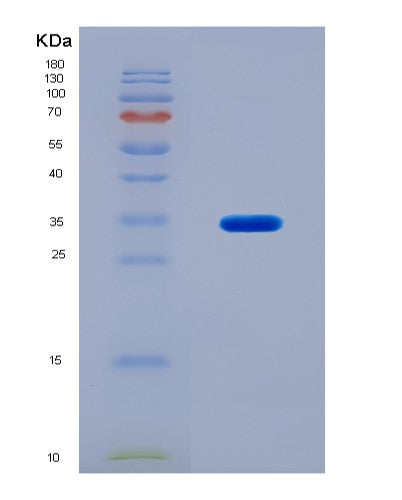 SDS-PAGE analysis of Human F2 (Prothrombin) - Recombinant Protein, CAT# BLT-08909P showing >90% purity under 15% SDS-PAGE (Reduced)
