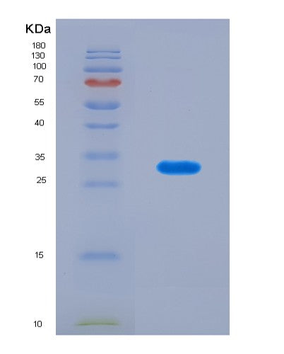 SDS-PAGE analysis of Mouse Prss22 (Brain-Specific Serine Protease 4) - Recombinant Protein, CAT# BLT-08910P showing >90% purity under 15% SDS-PAGE (Reduced)
