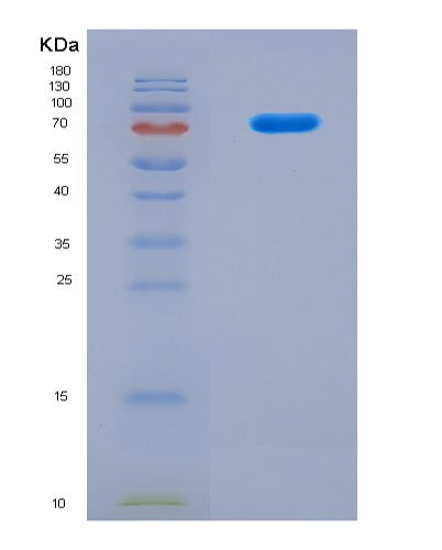 SDS-PAGE analysis of Human NSUN2 (Rna Cytosine C(5)-Methyltransferase Nsun2) - Recombinant Protein, CAT# BLT-08911P showing >90% purity under 15% SDS-PAGE (Reduced)