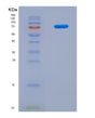 SDS-PAGE analysis of Human NSUN2 (Rna Cytosine C(5)-Methyltransferase Nsun2) - Recombinant Protein, CAT# BLT-08911P showing >90% purity under 15% SDS-PAGE (Reduced)