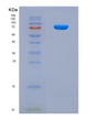 SDS-PAGE analysis of Human NSUN2 (Rna Cytosine C(5)-Methyltransferase Nsun2) - Recombinant Protein, CAT# BLT-08912P showing >90% purity under 15% SDS-PAGE (Reduced)