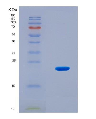 SDS-PAGE analysis of Human EPAS1 (Endothelial Pas Domain-Containing Protein 1) - Recombinant Protein, CAT# BLT-08913P showing >90% purity under 15% SDS-PAGE (Reduced)